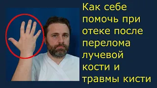 Как себе помочь при отёке после перелома лучевой кости и травмы кисти.