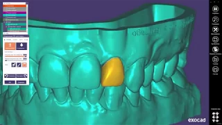 Моделирование одиночной коронки(создание зеркальной копии) + создание мастер-модели в Exocad