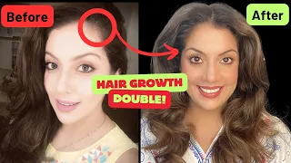 Double your hair growth | Hair transformation series | Nipun Kapur