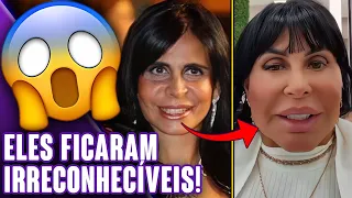 FAMOSOS QUE FIZERAM HARMONIZAÇÃO FACIAL E FICARAM MUITO DIFERENTES! | Virou Festa