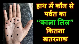 हाथ में कौन से पर्वत का काला तिल कितना खतरनाक  | Black Mole in Palmistry