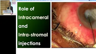 AIOC2019   IC458   Topic   Fungal keratitis   Dr Samar Kumar Basak   x264