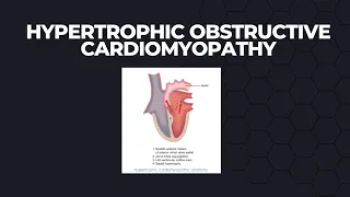 Hypertrophic Obstructive Cardiomyopathy