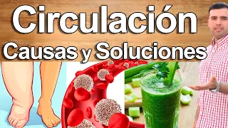 MALA CIRCULACIÓN Y VARICES NUNCA MÁS - Sus Causas y Soluciones - Como Mejorar la Circulación Sangre