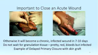 Webinar: Wound Care in Resource Limited Settings - Dr. Louis L. Carter, Jr., FACS (2013)