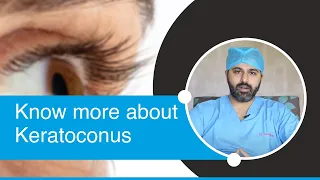 Keratoconus Eye Disease | Keratoconus Explained By Dr. Tushar Grover