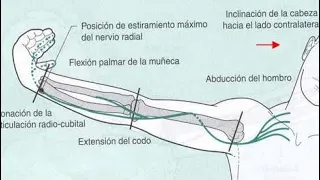 Ejercicio de Neurodinamia | Nervio Radial 🦴