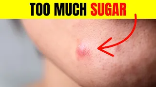 15 Signs You Are Eating Too Much Sugar