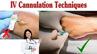 #How To Insert IV Cannula / IV Cannulation Techniques