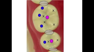 Occlusion for the Dental Staff