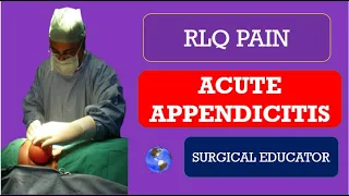 ACUTE APPENDICITIS-  How To DIAGNOSE & TREAT / RLQ PAIN