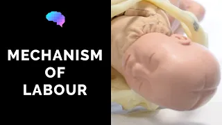 Mechanism of Labour & Fetal Positions - OSCE Guide