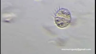 El ciliado Halteria saltando - The ciliate Halteria jumping