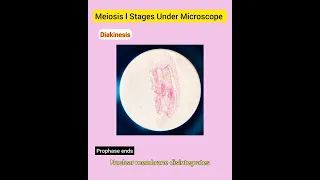 Meiosis l Stages Under Microscope