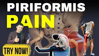 Top 3 Exercises for Piriformis Syndrome Pain Relief. MUST TRY!