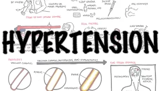 Hypertension - Overview (causes, pathophysiology, investigations, treatment