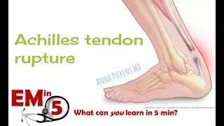 Achilles Tendon Rupture