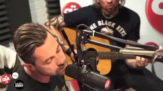 Les Fatals Picards - Gros Con - Session Acoustique OÜI FM