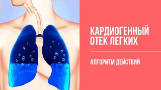 Неотложные состояния: Отек легких.