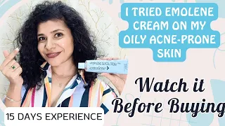 I tried emolene cream on my oily acne-prone skin | Detailed review with all kinds of experiments