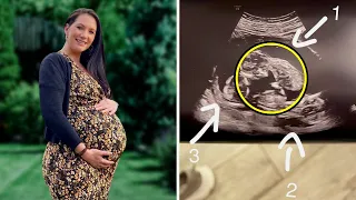 Mom's Jaw Drops when she Discovers 1-in-200 million secrets in her Belly!