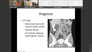 UW Urology Grand Rounds: "UPJ Management" – 2/2/2022