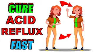 11 Natural ACID REFLUX Treatments for Quick Relief | FOODS To Calm Acid Reflux