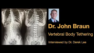 Dr. John Braun, Vertebral Body Tethering (VBT) Non-Fusion Scoliosis Surgery, by Dr. Derek Lee