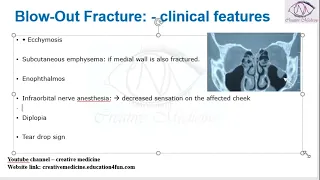 Lec 2 Blow Out Fracture   clinical features mp4 || OPHTHALMOLOGY