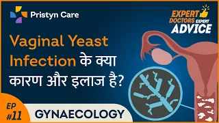 Symptoms, Causes & Treatment of Vaginal Yeast Infection