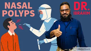 Nasal Polyps Ka Ilajj | Treatment for Nasal Polyps | Nose Blister | Dr. M. Ibrahim