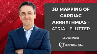 3D Mapping of cardiac arrhythmias - atrial flutter | Dr Jose Osorio