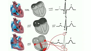 ECG de A à Z : la physiologie cardiaque prt 3 (la conduction electrique du coeur)