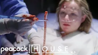 25ft Long Tape Worm | House M.D.