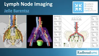 Lymph Node Staging Jelle Barentsz 2020