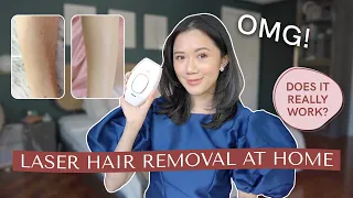 I Tried At Home Laser Hair Removal (Does It Work?) | Camille Co