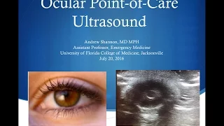 Jacobi Grand Rounds: Ocular Point-of-Care Ultrasound