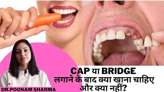 दांतों पर CAP या BRIDGE लगाने के बाद किन बातों का ध्यान रखें |खाने में क्या खाना चाहिए और क्या नहीं