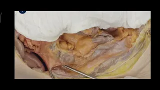 Surgical Anatomy of the Colon (Incision Academy)