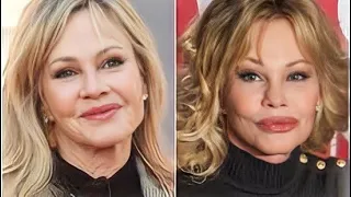 La FAMOSA ACTRIZ que quería ser más BELLA y se DEF0RMÓ el ROSTRO - La historia de Melanie Griffith