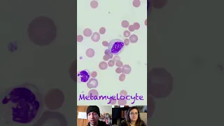 Metamyelocyte Morphological Characteristics