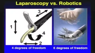 The Evolution of Robotic Nephron Sparing Surgery for Renal Cell Carcinoma