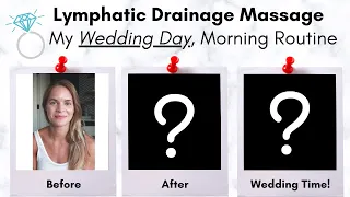 My Wedding Day Lymphatic Drainage Massage Before and After - Done by a Lymphedema Physical Therapist