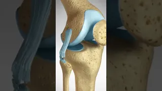 See how an ACL LCL Tear is repaired