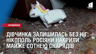 Шестирічна дівчинка залишилась без ніг: Нікополь росіяни накрили майже сотнею снарядів