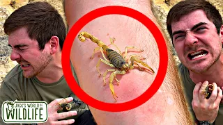 STUNG By The LARGEST SCORPION Species In NORTH AMERICA! Desert Hairy Scorpion Sting Test!