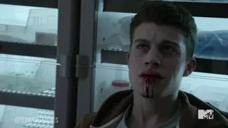 Teen wolf 6x20 》Theo Taking His Pain Away for Him