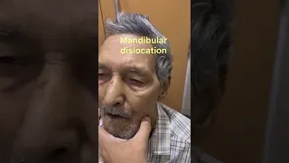 Temporomandibular (TMJ)Joint Dislocation Reduction Technique, Mandibular dislocation,Jaw dislocation