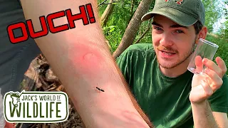 MOST Painful ANT STING In TEXAS? STUNG by Pachycondyla harpax!