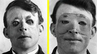 10 Gruesome Victorian Era Medical Treatments That Will Freak You Out